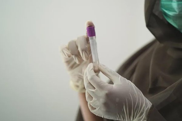 策略股 体检时这9项指标都正常，说明你的身体还不错，真正达标的人不多